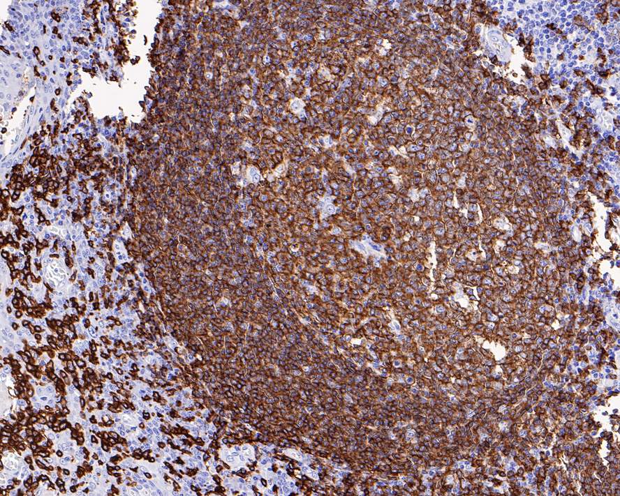 CD20 Antibody (PD00-02)