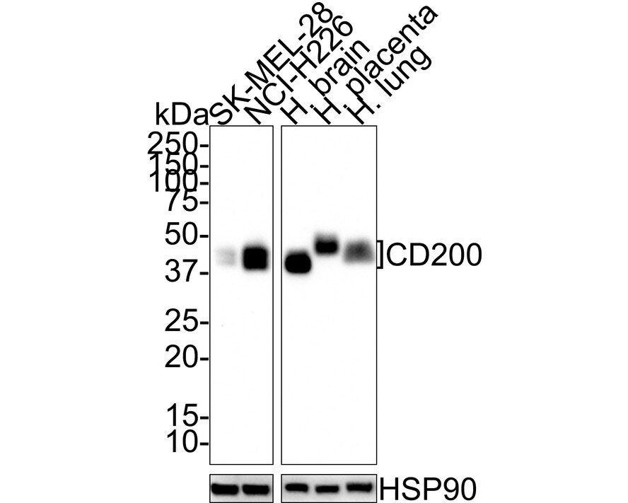 CD200/OX2 Antibody (PSH01-48) Western Blot: CD200/OX2 Antibody (PSH01-48) [NBP3-32132]