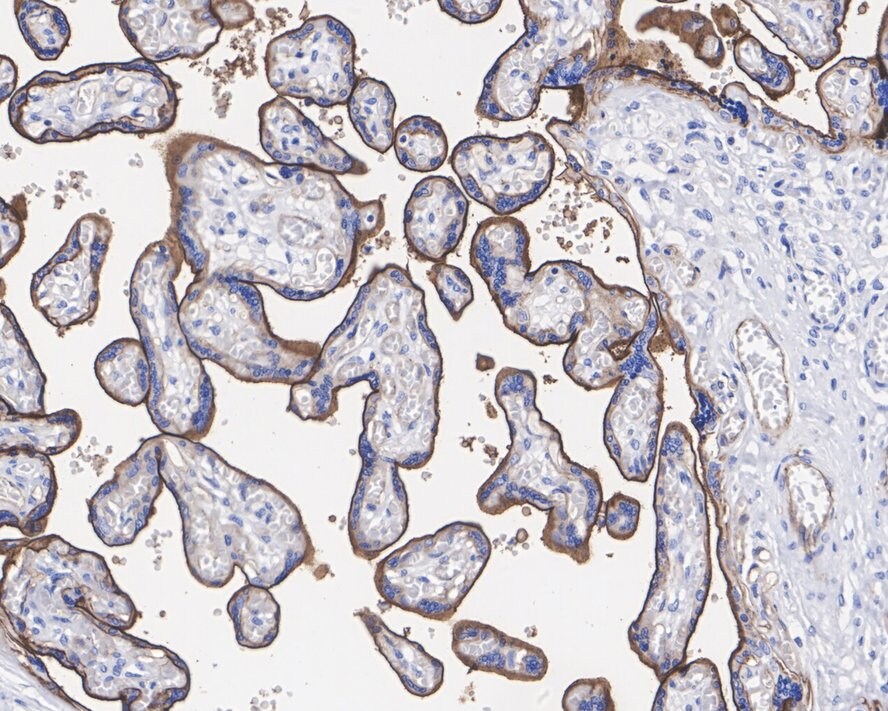 CD200/OX2 Antibody (PSH01-48)