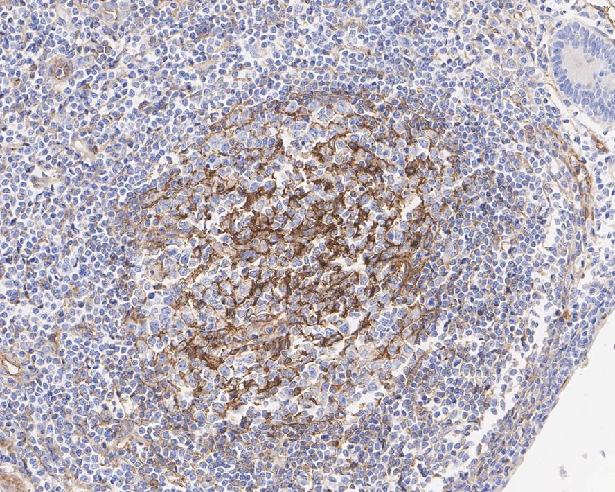 CD200/OX2 Antibody (PSH01-49)