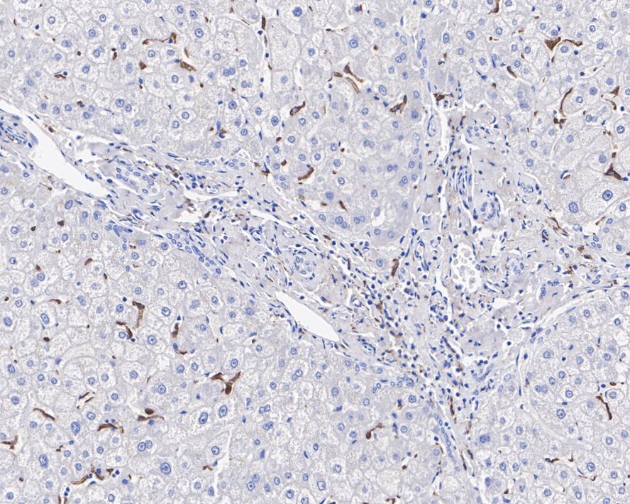 SR-AI/MSR Antibody (A8G2-R)