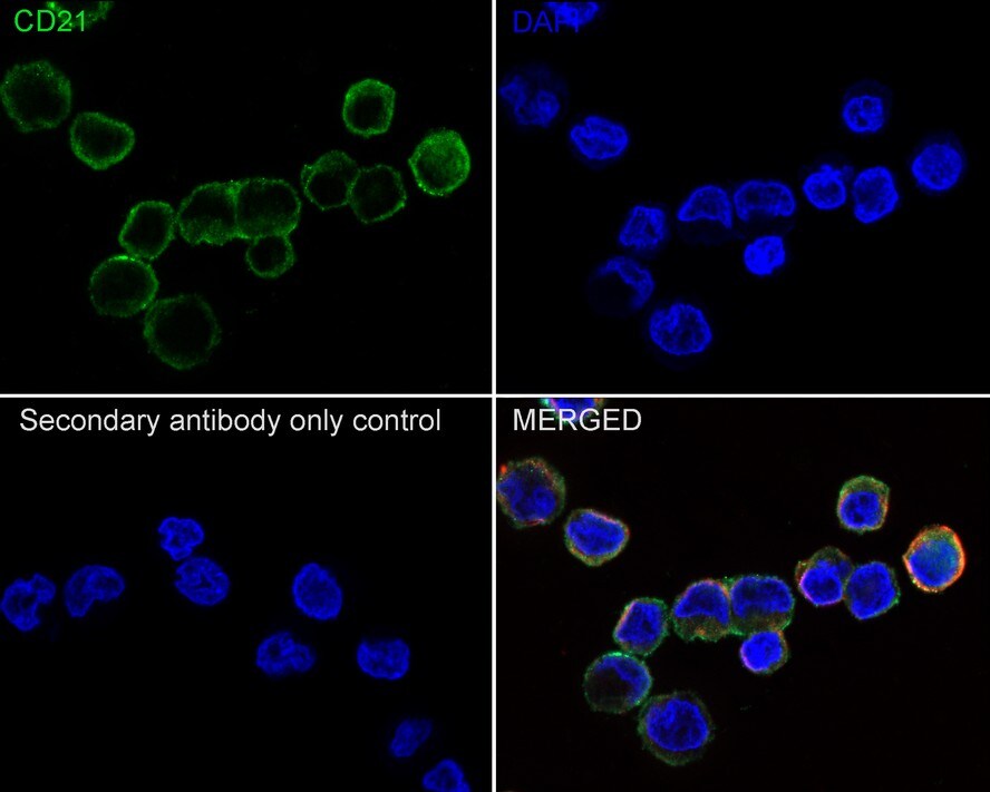 CD21 Antibody (PD00-23)