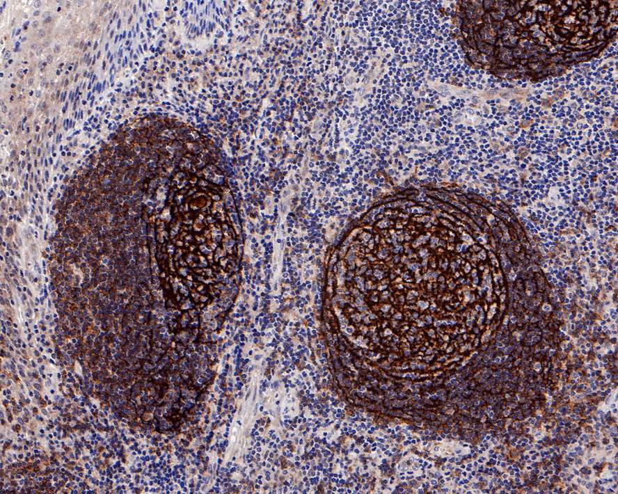 CD21 Antibody (PD00-23)
