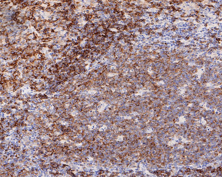 Siglec-2/CD22 Antibody (PO00-31)