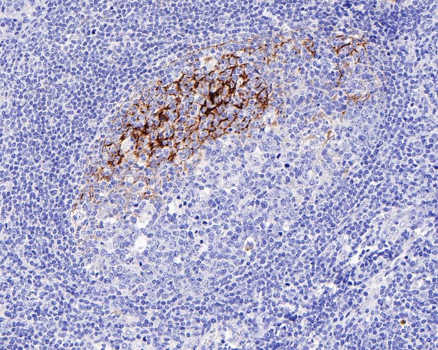 CD23/Fc epsilon RII Antibody (PD00-03)
