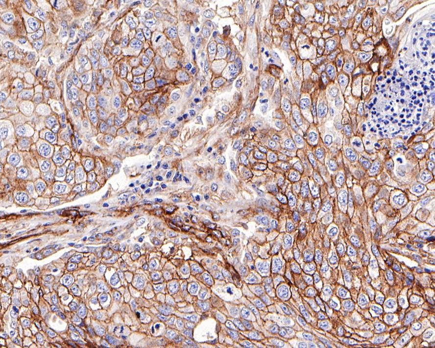 B7-H3/CD276 Antibody (PD00-36)