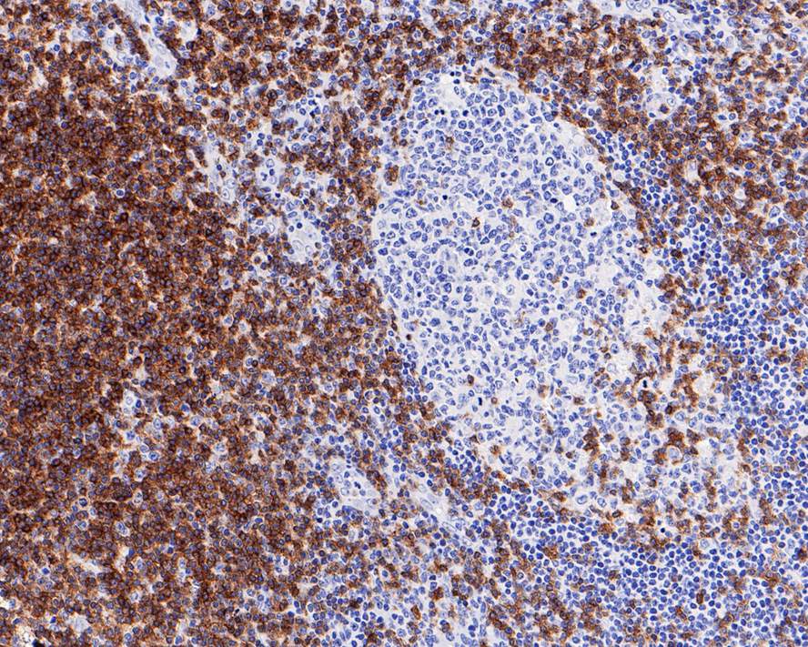 CD3 Antibody (PD01-43)