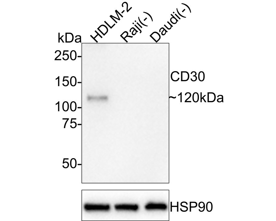 CD30/TNFRSF8 Antibody (JE57-71) Western Blot: CD30/TNFRSF8 Antibody (JE57-71) [NBP3-32141]