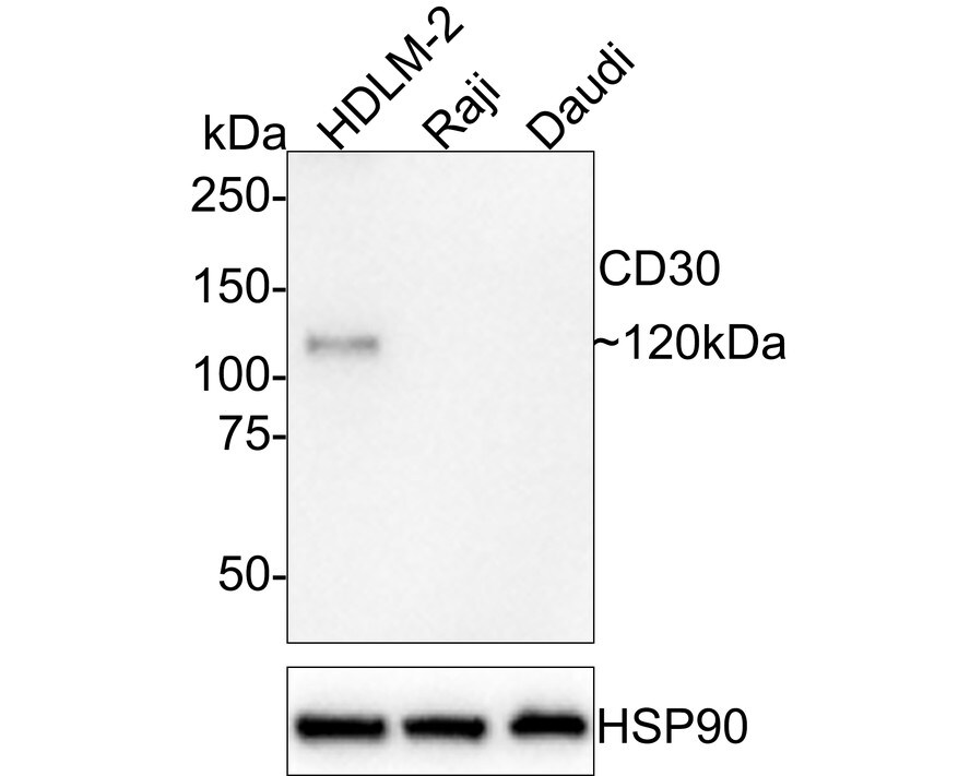 CD30/TNFRSF8 Antibody (JE57-71)