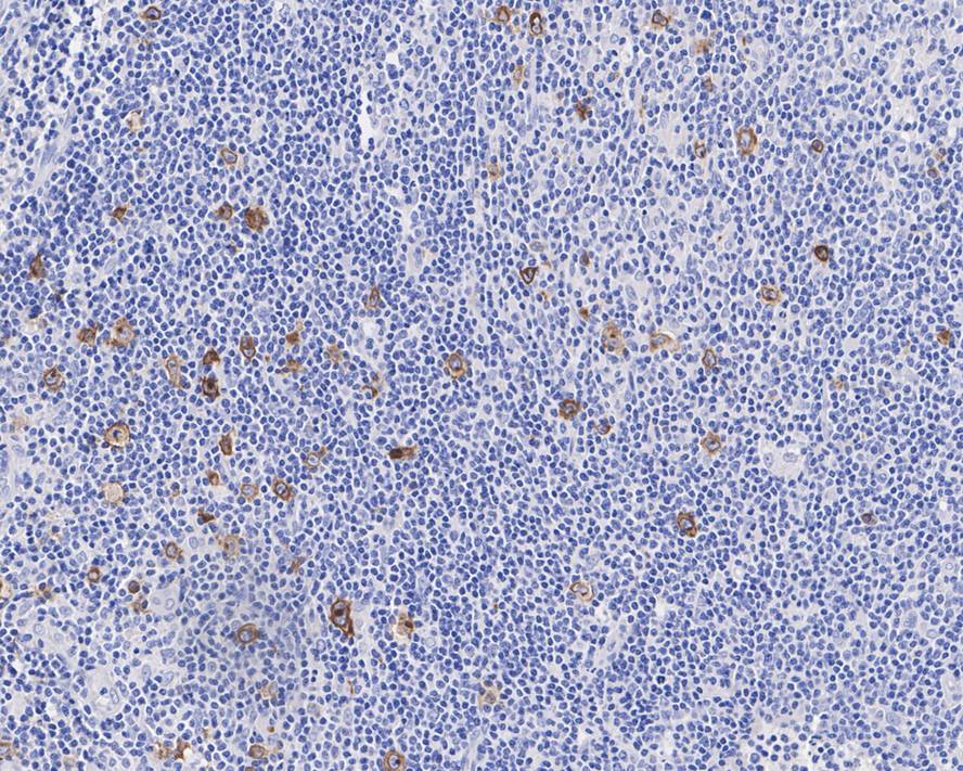 CD30/TNFRSF8 Antibody (JE57-71)