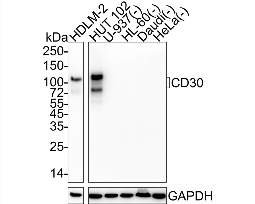 CD30/TNFRSF8 Antibody (PSH04-10) Western Blot: CD30/TNFRSF8 Antibody (PSH04-10) [NBP3-32142]