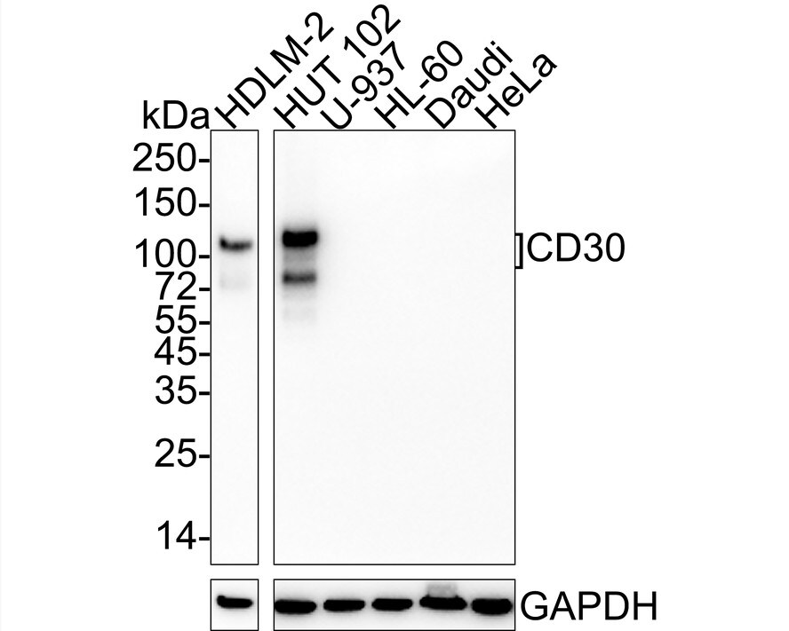 CD30/TNFRSF8 Antibody (PSH04-10)