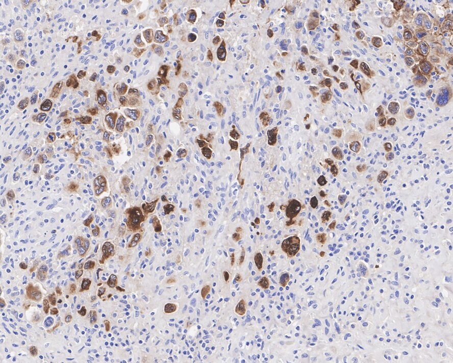 CD30/TNFRSF8 Antibody (PSH04-10)