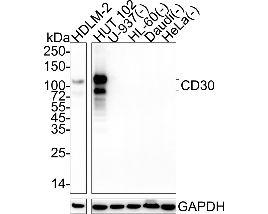 CD30/TNFRSF8 Antibody (PSH04-11) Western Blot: CD30/TNFRSF8 Antibody (PSH04-11) [NBP3-32143]
