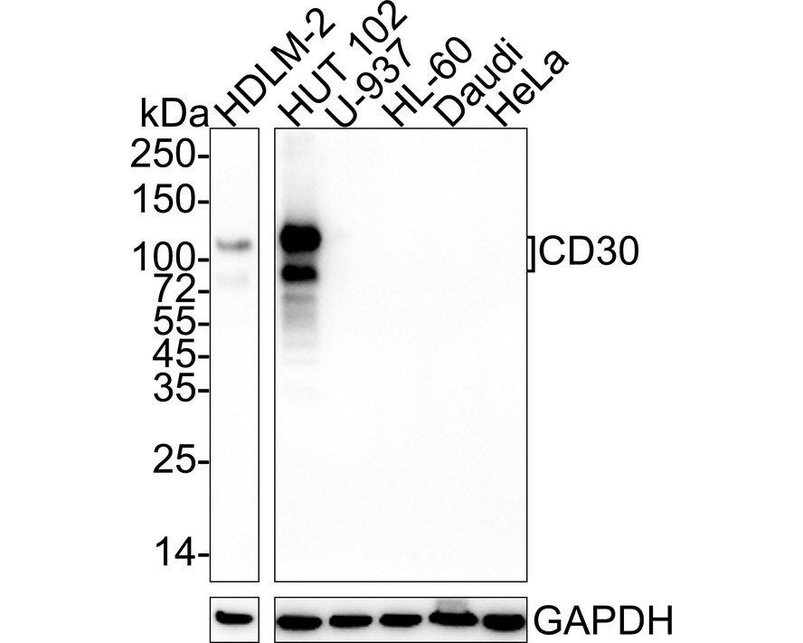 CD30/TNFRSF8 Antibody (PSH04-11)