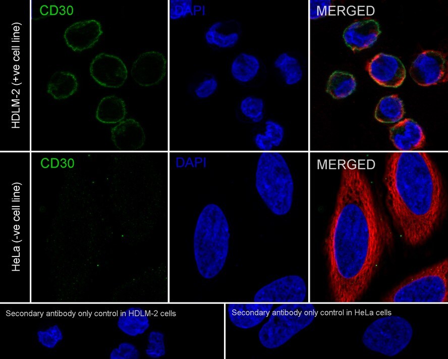 CD30/TNFRSF8 Antibody (PSH04-11)