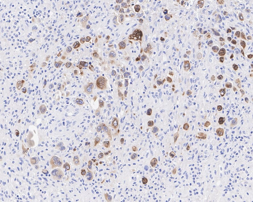 CD30/TNFRSF8 Antibody (PSH04-11)