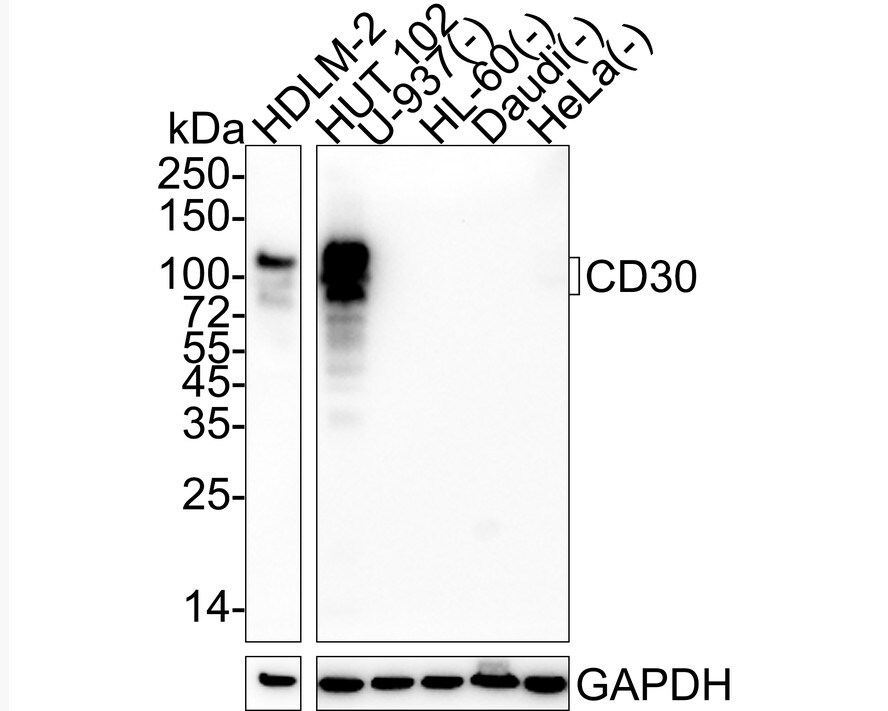 CD30/TNFRSF8 Antibody (PSH04-12) Western Blot: CD30/TNFRSF8 Antibody (PSH04-12) [NBP3-32144]