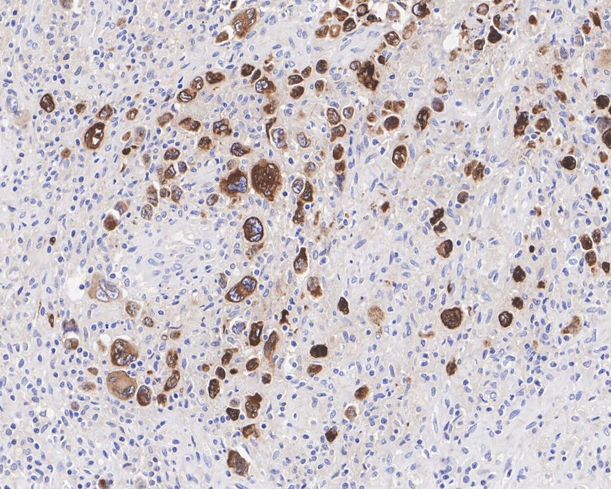 CD30/TNFRSF8 Antibody (PSH04-12)