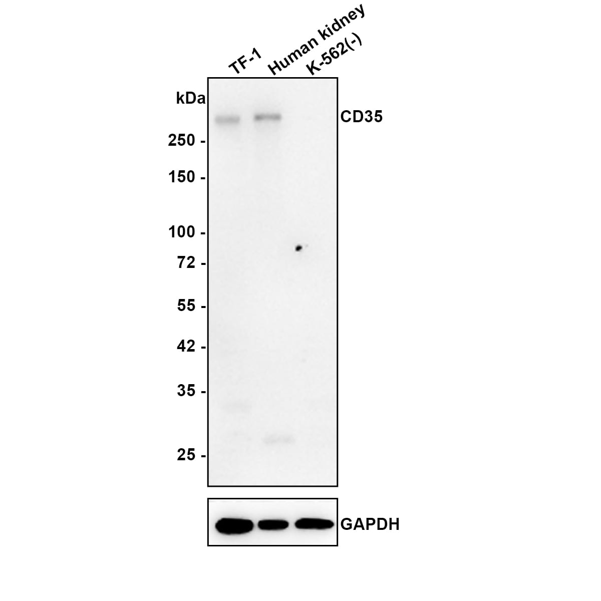 CD35 Antibody (A4F3-R) Western Blot: CD35 Antibody (A4F3-R) [NBP3-32149]