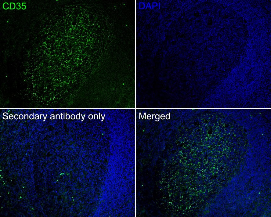 CD35 Antibody (A4F3-R)