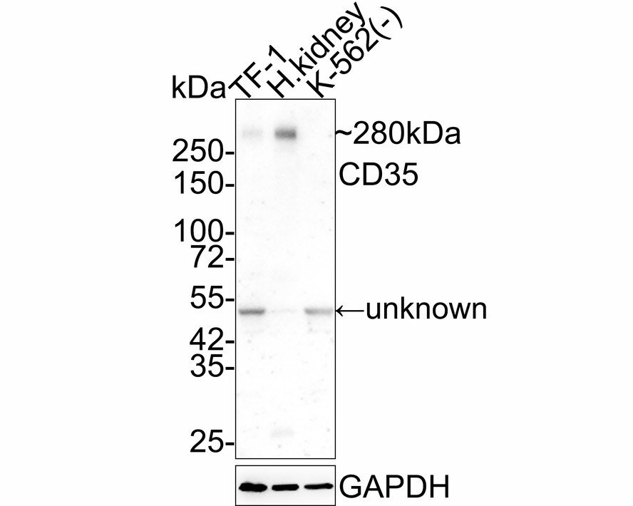 CD35 Antibody (A4G1-R) Western Blot: CD35 Antibody (A4G1-R) [NBP3-32150]