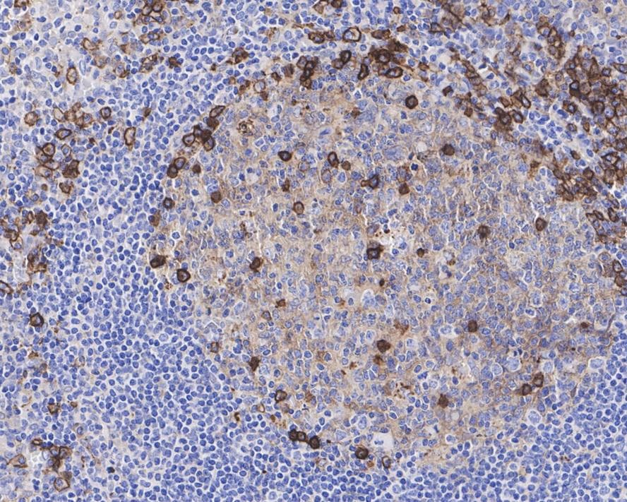 CD38 Antibody (PD01-49)