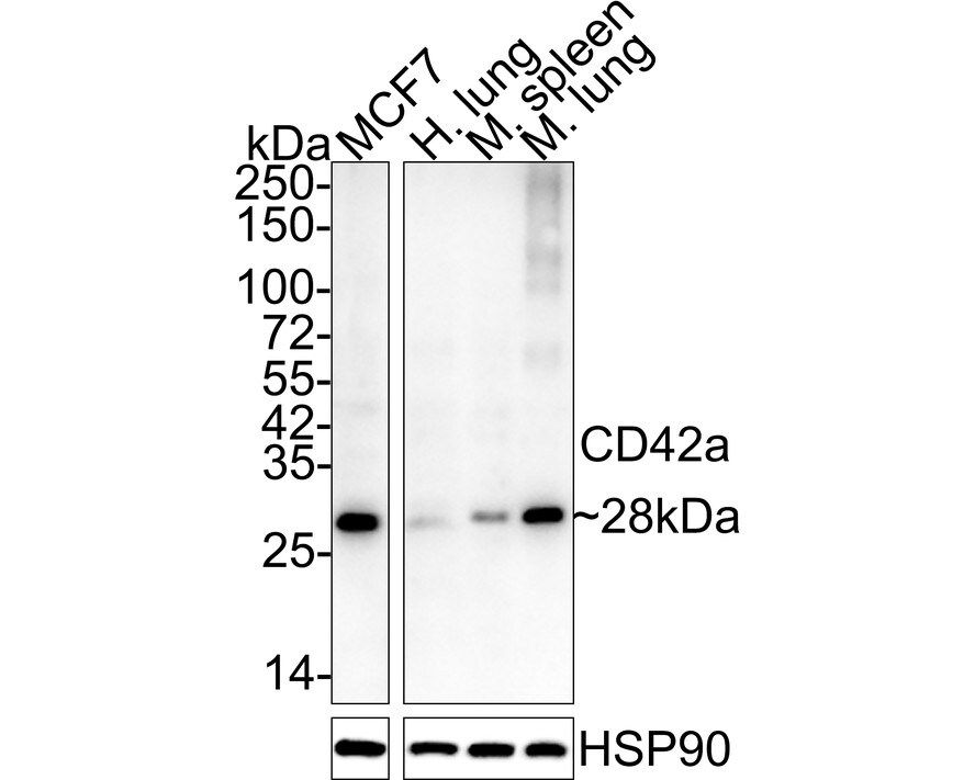 GP-IX Antibody (A5E6-R) Western Blot: GP-IX Antibody (A5E6-R) [NBP3-32152]