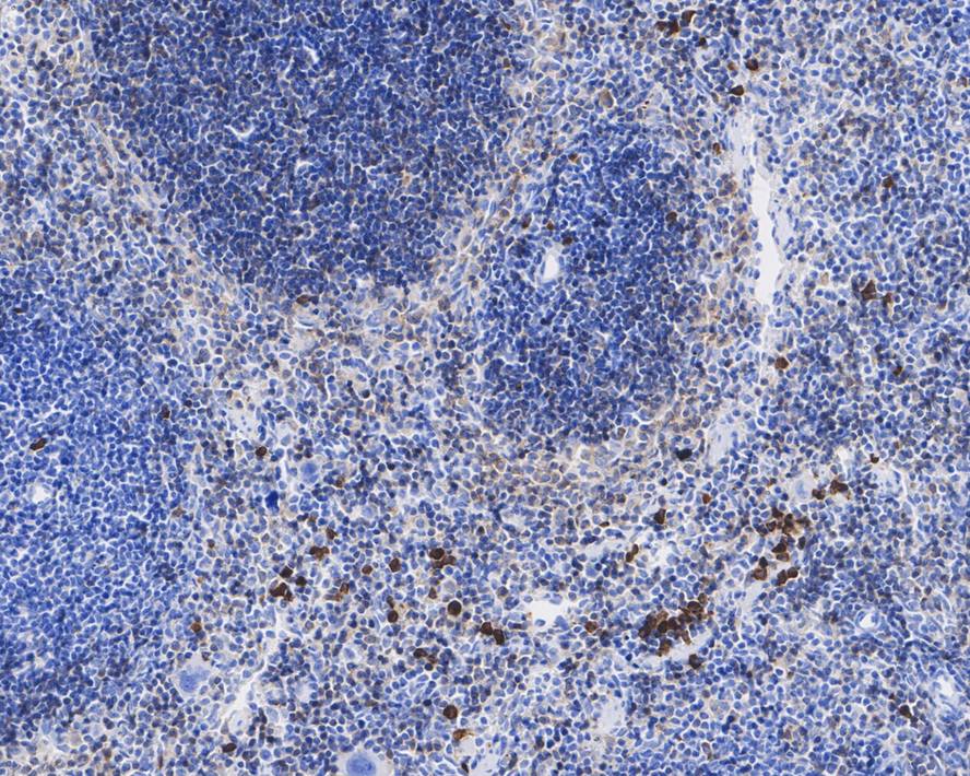 GP-IX Antibody (A5E6-R)