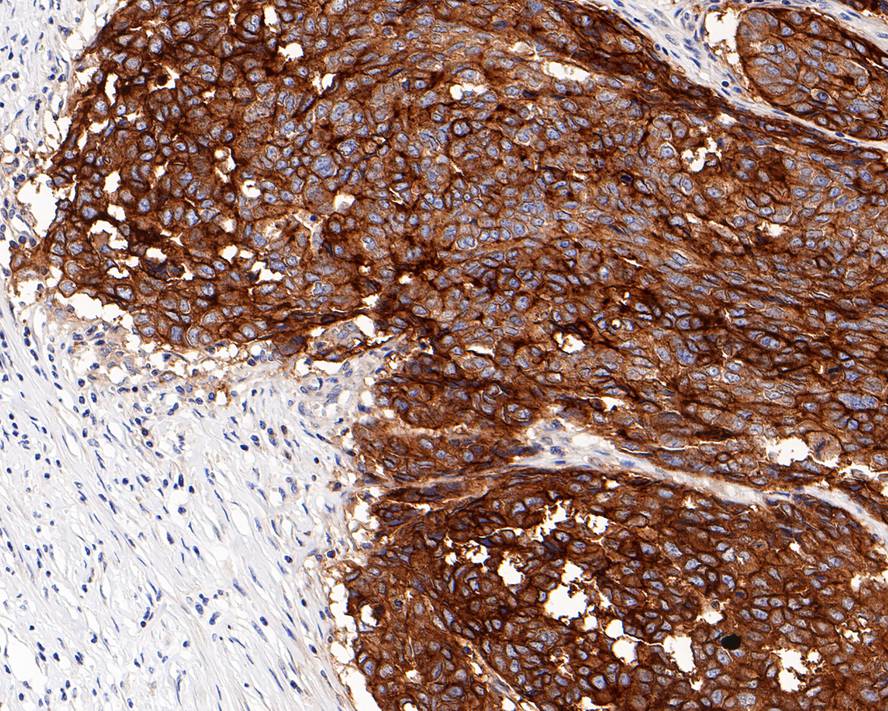 CD47 Antibody (PD00-33)