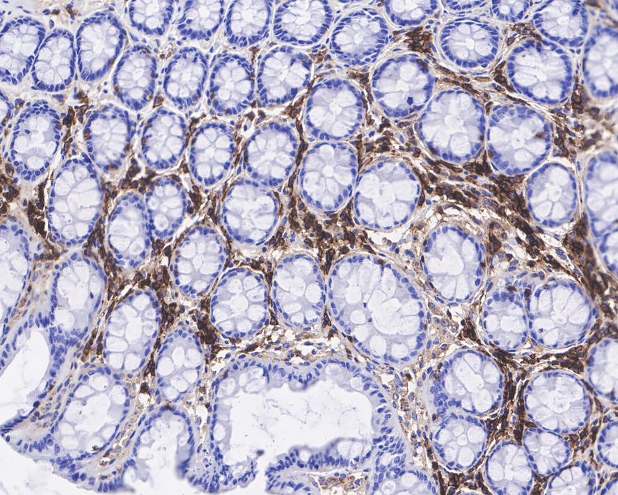CD48/SLAMF2 Antibody (JE37-98)
