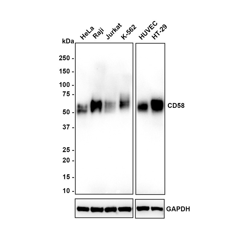 CD58/LFA-3 Antibody (PSH02-74) Western Blot: CD58/LFA-3 Antibody (PSH02-74) [NBP3-32161]