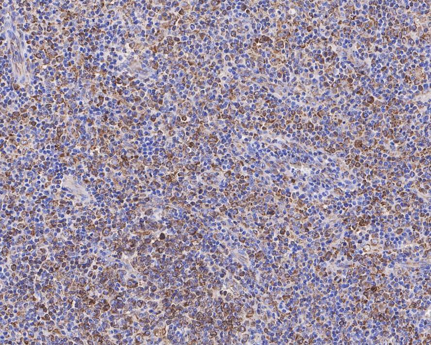 CD74 Antibody (PDM0-22)