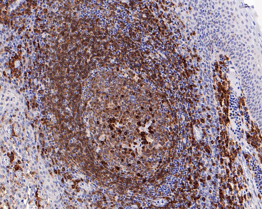 CD79A Antibody (PDM0-23)