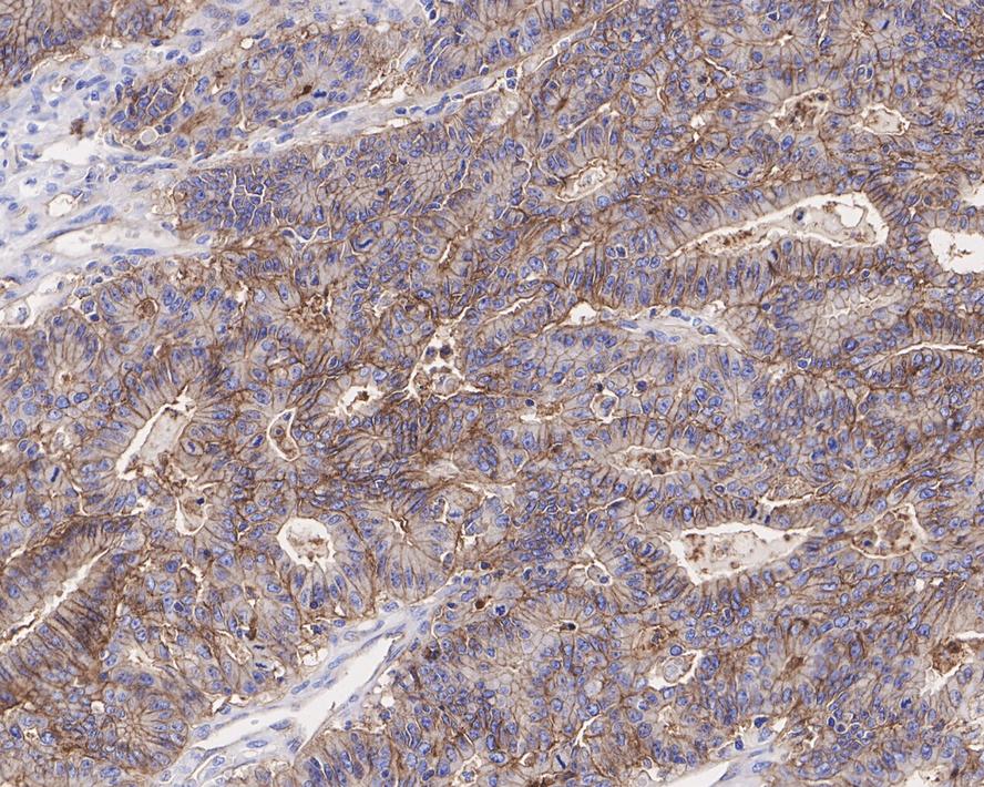 CD9 Antibody (PSH0-95)