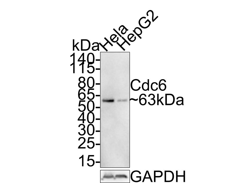 Cdc6 [p Ser54] Antibody (JE59-52) Western Blot: Cdc6 [p Ser54] Antibody (JE59-52) [NBP3-32174]
