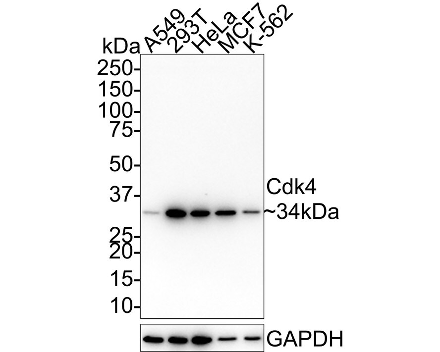 CDK4 Antibody (5-C3-G3-R) Western Blot: CDK4 Antibody (5-C3-G3-R) [NBP3-32175]