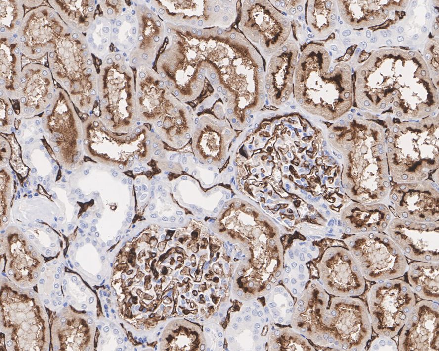 CEACAM1/CD66a Antibody (PSH0-78)