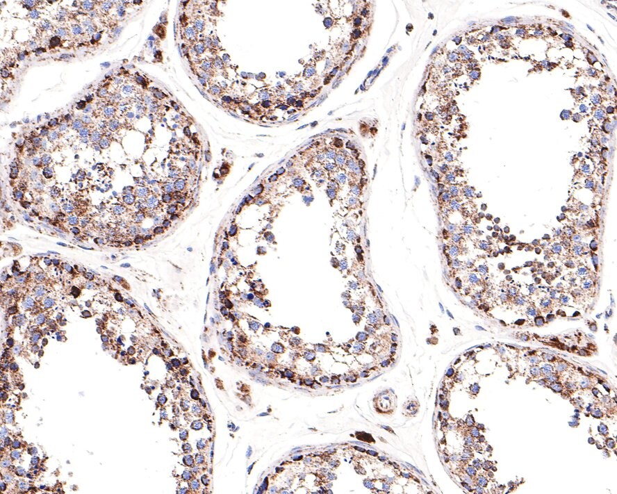 CECR5 Antibody (JE64-76)