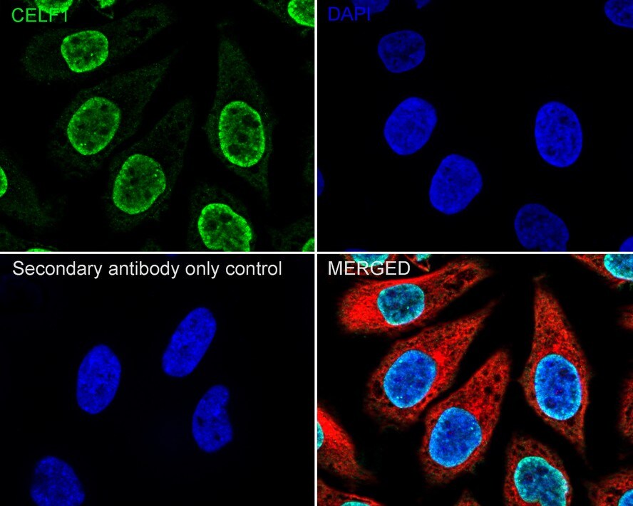 CUGBP1/CELF1 Antibody (7A1-R)