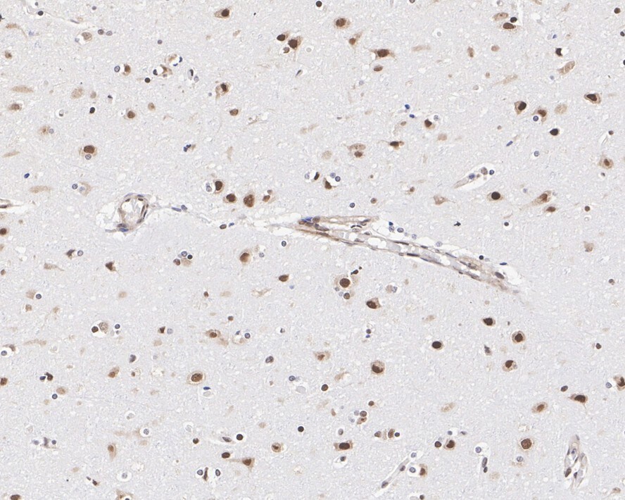 CUGBP1/CELF1 Antibody (7A1-R)