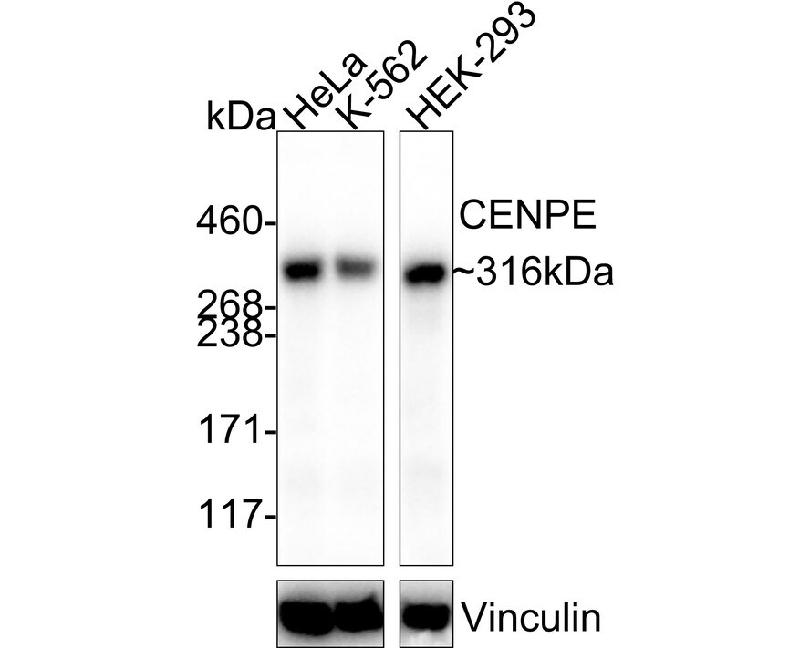 CENPE Antibody (PSH03-54) Western Blot: CENPE Antibody (PSH03-54) [NBP3-32180]
