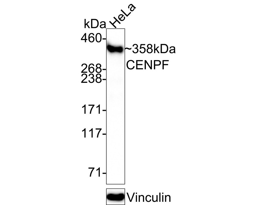 CENPF Antibody (PSH0-79) Western Blot: CENPF Antibody (PSH0-79) [NBP3-32181]
