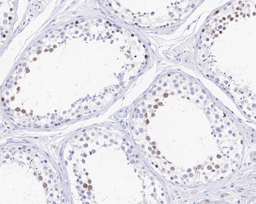 CENPF Antibody (PSH0-79)