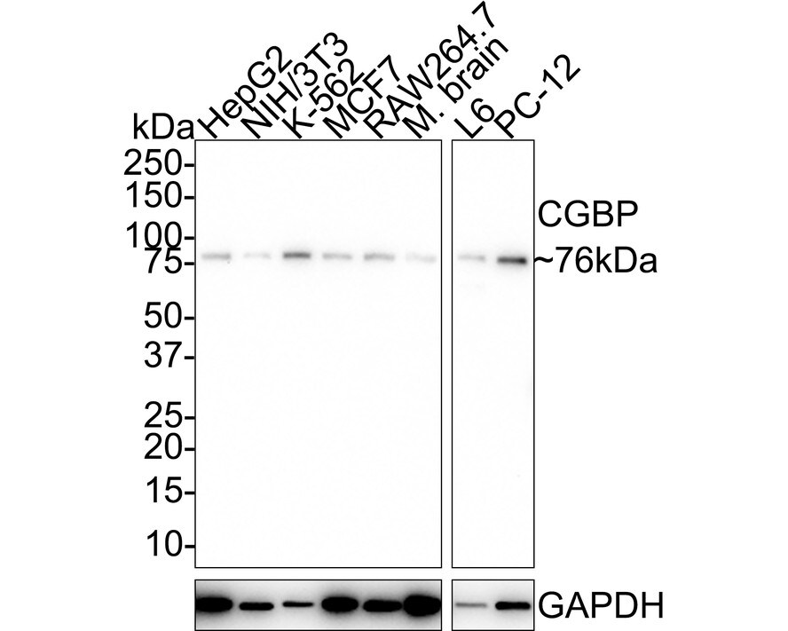 CXXC1 Antibody (PSH01-54) Western Blot: CXXC1 Antibody (PSH01-54) [NBP3-32183]