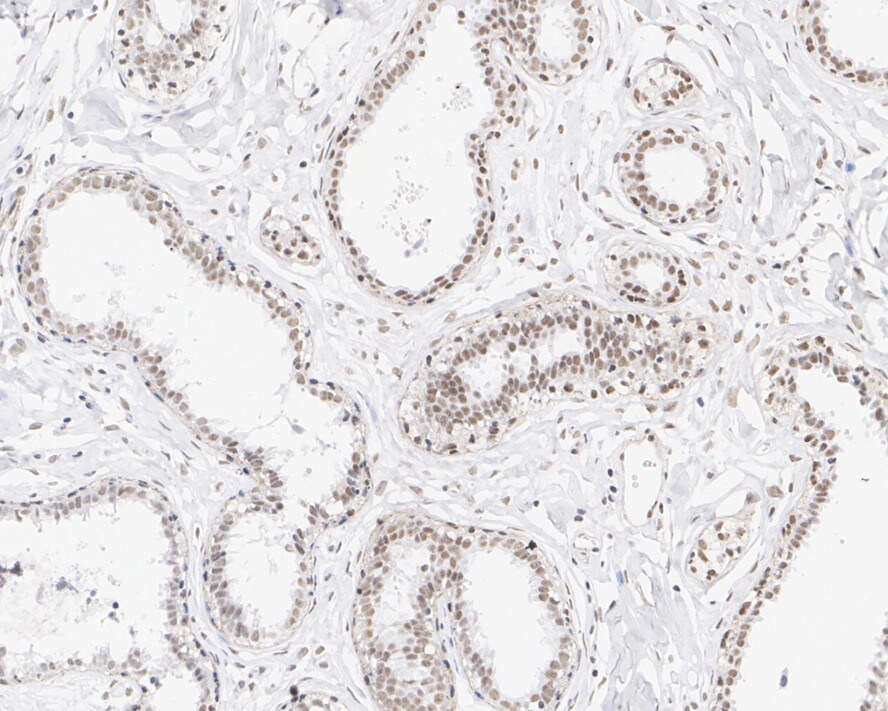 CXXC1 Antibody (PSH01-54)