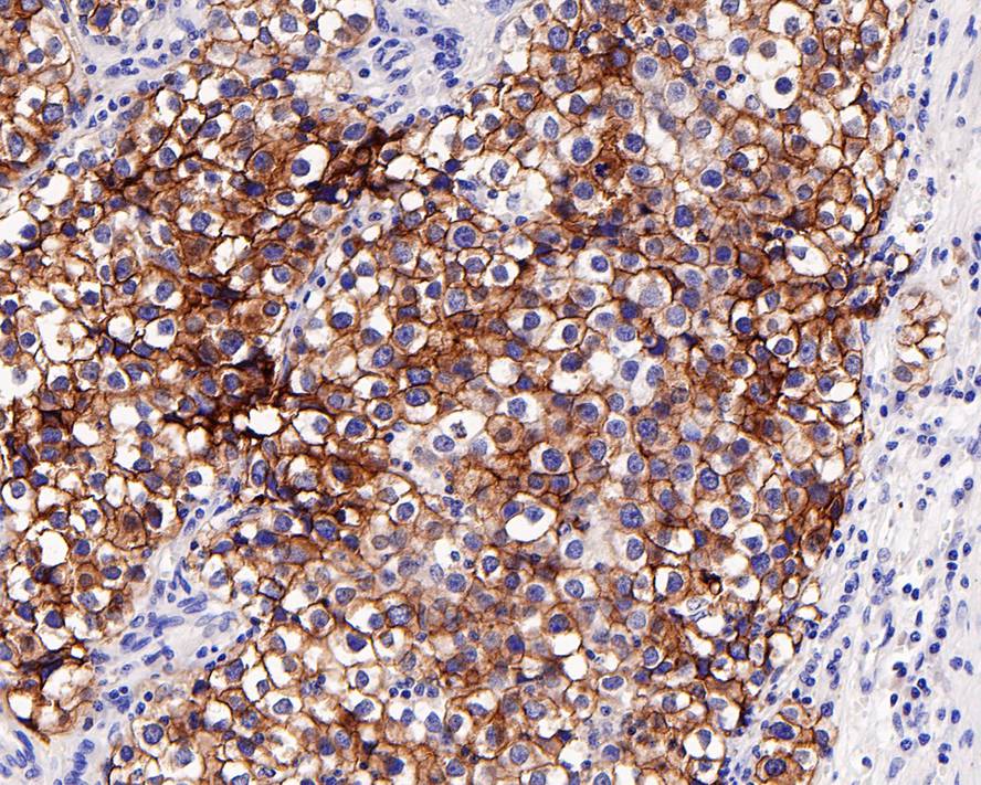 CD117/c-kit Antibody (PD00-24)