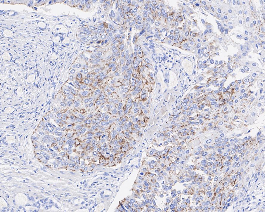 Claudin-1 Antibody (JE30-33)