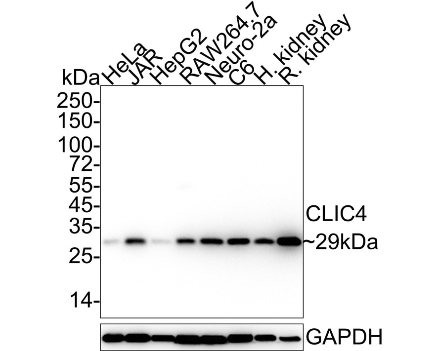 CLIC4 Antibody (JE65-09) Western Blot: CLIC4 Antibody (JE65-09) [NBP3-32192]