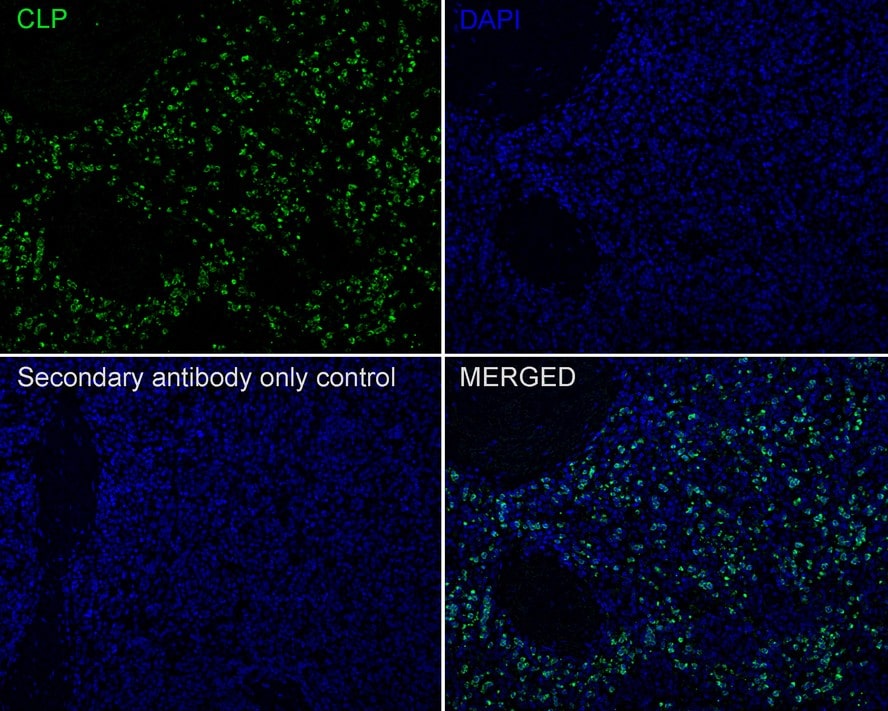 CAMP/LL37/FALL39/Cathelicidin Antibody (PSH01-72)